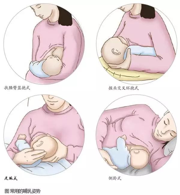 乳腺炎能不能喂奶？